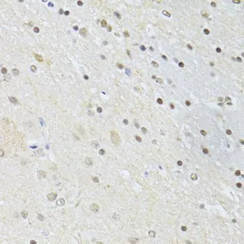 IHC-P analysis of rat brain tissue using GTX65930 CTCF antibody. Dilution : 1:100