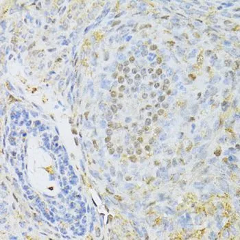 IHC-P analysis of rat ovary tissue using GTX65930 CTCF antibody. Dilution : 1:100