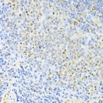 IHC-P analysis of rat spleen tissue using GTX65930 CTCF antibody. Dilution : 1:100