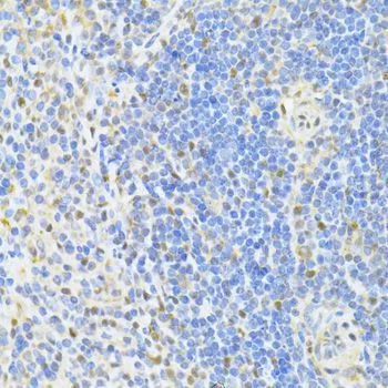 IHC-P analysis of mouse spleen tissue using GTX65930 CTCF antibody. Dilution : 1:100