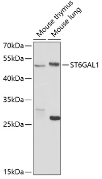 WB analysis of various sample lysates using GTX65933 Cdw75 antibody. Dilution : 1:1000 Loading : 25microg per lane WB analysis of various sample lysates using GTX65933 Cdw75 antibody. Dilution : 1:1000 Loading : 25microg per lane