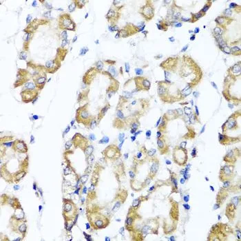 IHC-P analysis of human stomach tissue using GTX65933 Cdw75 antibody. Dilution : 1:100
