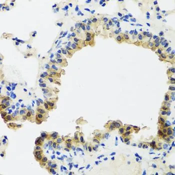 IHC-P analysis of mouse lung tissue using GTX65933 Cdw75 antibody. Dilution : 1:100