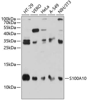 WB analysis of various sample lysates using GTX65938 S100A10 antibody. Dilution : 1:1000 Loading : 25microg per lane WB analysis of various sample lysates using GTX65938 S100A10 antibody. Dilution : 1:1000 Loading : 25microg per lane