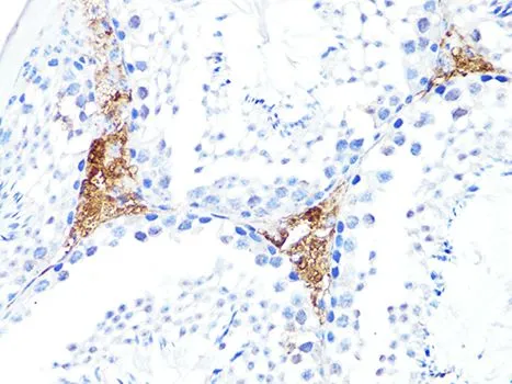 IHC-P analysis of mouse testis tissue using GTX65938 S100A10 antibody. Dilution : 1:100