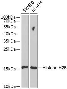 WB analysis of various sample lysates using GTX65940 HIST2H2BE antibody. Dilution : 1:1000 Loading : 25microg per lane