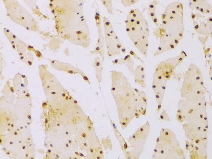 IHC-P analysis of human esophagus tissue using GTX65940 HIST2H2BE antibody. Dilution : 1:100