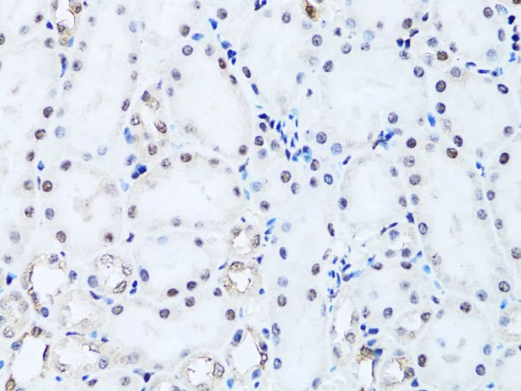 IHC-P analysis of rat kidney tissue using GTX65940 HIST2H2BE antibody. Dilution : 1:100