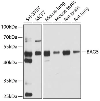 WB analysis of various sample lysates using GTX65944 BAG5 antibody. The signal was developed with ECL plus-Enhanced. Dilution : 1:1000 Loading : 25microg per lane WB analysis of various sample lysates using GTX65944 BAG5 antibody. The signal was developed with ECL plus-Enhanced. Dilution : 1:1000 Loading : 25microg per lane