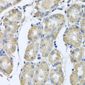 IHC-P analysis of human stomach tissue using GTX65944 BAG5 antibody. Dilution : 1:100
