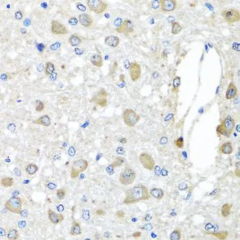 IHC-P analysis of rat brain tissue using GTX65944 BAG5 antibody. Dilution : 1:100