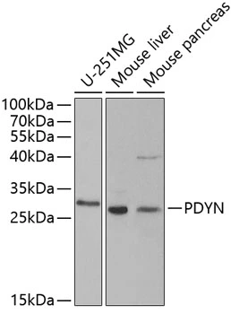 WB analysis of various sample lysates using GTX65945 ProDynorphin antibody. Dilution : 1:1000 Loading : 25microg per lane WB analysis of various sample lysates using GTX65945 ProDynorphin antibody. Dilution : 1:1000 Loading : 25microg per lane
