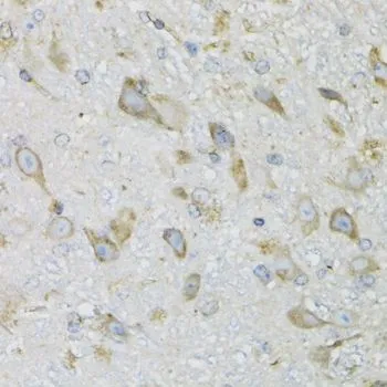 IHC-P analysis of mouse brain tissue using GTX65945 ProDynorphin antibody. Dilution : 1:100