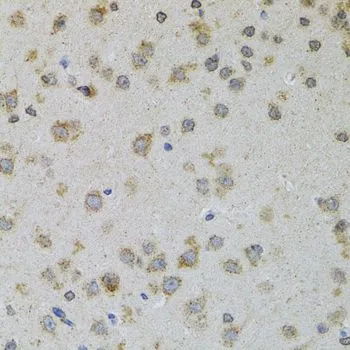 IHC-P analysis of rat brain tissue using GTX65945 ProDynorphin antibody. Dilution : 1:100