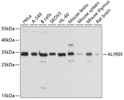 WB analysis of various sample lysates using GTX65947 ALY antibody. Dilution : 1:1000 Loading : 25microg per lane WB analysis of various sample lysates using GTX65947 ALY antibody. Dilution : 1:1000 Loading : 25microg per lane