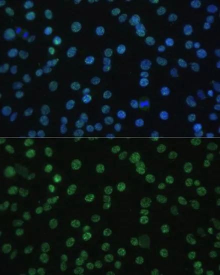 ICC/IF analysis of C6 cells using GTX65947 ALY antibody. Blue : DAPI Dilution : 1:100