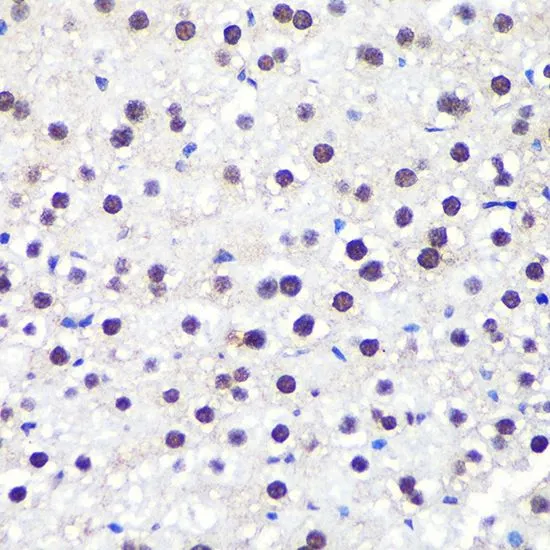 IHC-P analysis of mouse liver tissue using GTX65947 ALY antibody. Dilution : 1:100