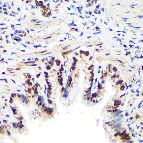 IHC-P analysis of rat lung tissue using GTX65947 ALY antibody. Dilution : 1:100