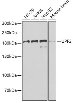 WB analysis of various sample lysates using GTX65954 Rent2 antibody. Dilution : 1:1000 Loading : 25microg per lane WB analysis of various sample lysates using GTX65954 Rent2 antibody. Dilution : 1:1000 Loading : 25microg per lane