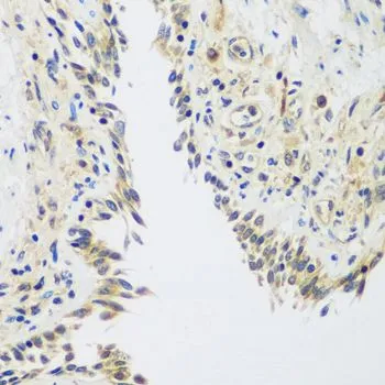 IHC-P analysis of human lung tissue using GTX65954 Rent2 antibody. Dilution : 1:100