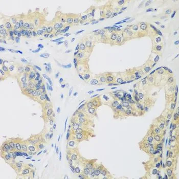 IHC-P analysis of human prostate tissue using GTX65954 Rent2 antibody. Dilution : 1:100
