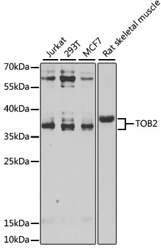 WB analysis of various sample lysates using GTX65957 TOB2 antibody. The signal was developed with ECL plus-Enhanced. Dilution : 1:1000 Loading : 25microg per lane WB analysis of various sample lysates using GTX65957 TOB2 antibody. The signal was developed with ECL plus-Enhanced. Dilution : 1:1000 Loading : 25microg per lane