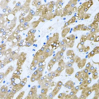 IHC-P analysis of human liver damage tissue using GTX65957 TOB2 antibody. Dilution : 1:100