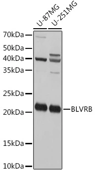 WB analysis of various sample lysates using GTX65958 Flavin reductase antibody. Dilution : 1:1000 Loading : 25microg per lane WB analysis of various sample lysates using GTX65958 Flavin reductase antibody. Dilution : 1:1000 Loading : 25microg per lane