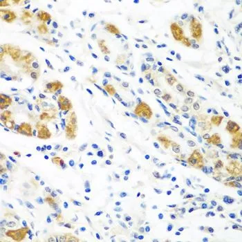 IHC-P analysis of human stomach tissue using GTX65958 Flavin reductase antibody. Dilution : 1:100
