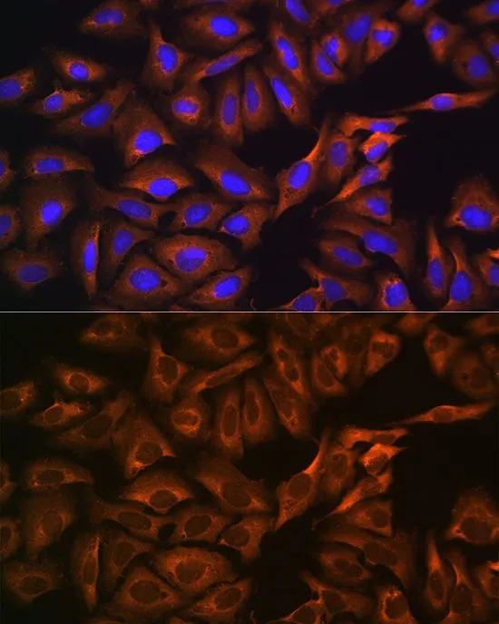 ICC/IF analysis of U2OS cells using GTX65964 GPIP137 antibody. Blue : DAPI Dilution : 1:100