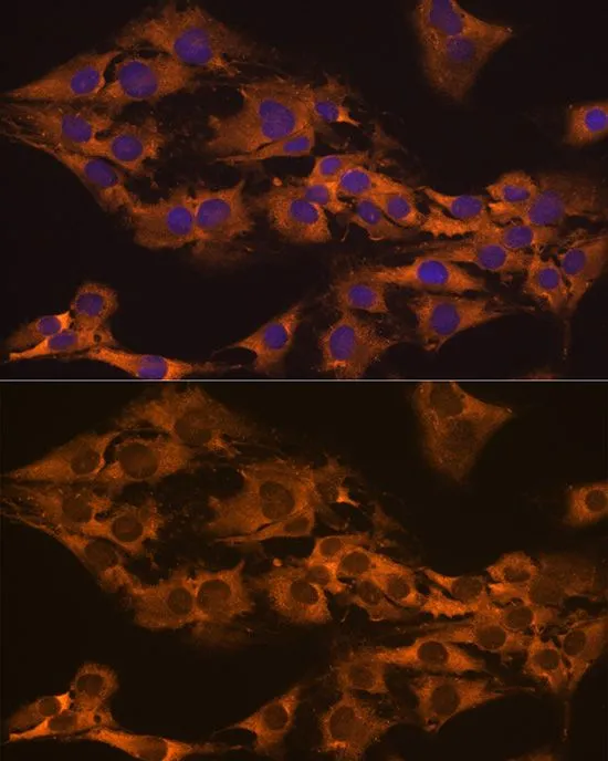 ICC/IF analysis of C6 cells using GTX65964 GPIP137 antibody. Blue : DAPI Dilution : 1:100