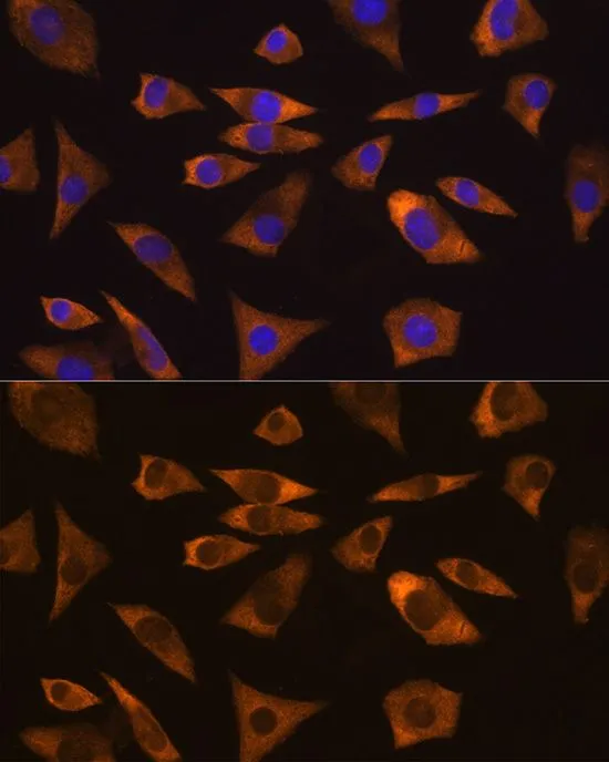 ICC/IF analysis of L929 cells using GTX65964 GPIP137 antibody. Blue : DAPI Dilution : 1:100
