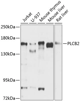 WB analysis of various sample lysates using GTX65967 PLCB2 antibody. Dilution : 1:1000 Loading : 25microg per lane WB analysis of various sample lysates using GTX65967 PLCB2 antibody. Dilution : 1:1000 Loading : 25microg per lane