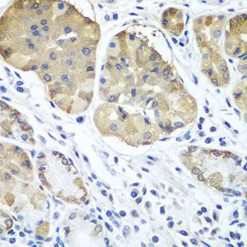 IHC-P analysis of human stomach tissue using GTX65967 PLCB2 antibody. Dilution : 1:100