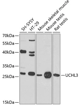 WB analysis of various sample lysates using GTX65968 UCHL3 antibody. Dilution : 1:1000 Loading : 25microg per lane WB analysis of various sample lysates using GTX65968 UCHL3 antibody. Dilution : 1:1000 Loading : 25microg per lane