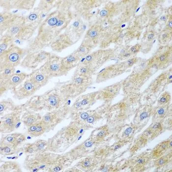 IHC-P analysis of human liver tissue using GTX65968 UCHL3 antibody. Dilution : 1:100