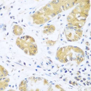 IHC-P analysis of human stomach tissue using GTX65968 UCHL3 antibody. Dilution : 1:100