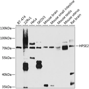 WB analysis of various sample lysates using GTX65971 HPA2 antibody. Dilution : 1:1000 Loading : 25microg per lane WB analysis of various sample lysates using GTX65971 HPA2 antibody. Dilution : 1:1000 Loading : 25microg per lane