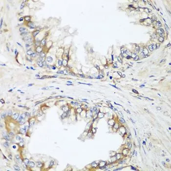 IHC-P analysis of human prostate tissue using GTX65971 HPA2 antibody. Dilution : 1:100