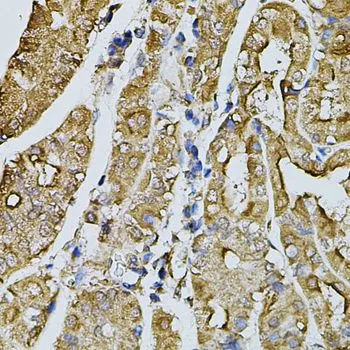 IHC-P analysis of human stomach tissue using GTX65975 Fast skeletal myosin light chain 1 antibody. Dilution : 1:100