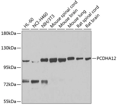 WB analysis of various sample lysates using GTX65979 PCDHA12 antibody. Dilution : 1:1000 Loading : 25microg per lane WB analysis of various sample lysates using GTX65979 PCDHA12 antibody. Dilution : 1:1000 Loading : 25microg per lane