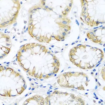 IHC-P analysis of human stomach tissue using GTX65979 PCDHA12 antibody. Dilution : 1:100