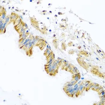 IHC-P analysis of human trachea tissue using GTX65979 PCDHA12 antibody. Dilution : 1:100
