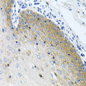 IHC-P analysis of rat brain tissue using GTX65984 GLCNE antibody. Dilution : 1:100