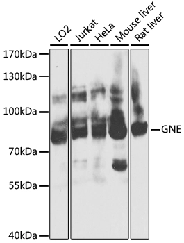WB analysis of various sample lysates using GTX65984 GLCNE antibody. Dilution : 1:1000 Loading : 25microg per lane