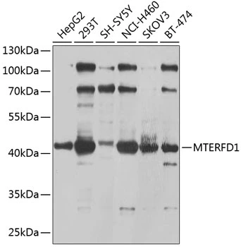 WB analysis of various sample lysates using GTX65988 MTERFD1 antibody. Dilution : 1:1000 Loading : 25microg per lane
