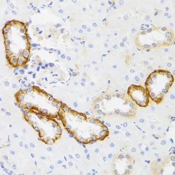IHC-P analysis of rat kidney tissue using GTX65990 MYO5A antibody. Dilution : 1:100