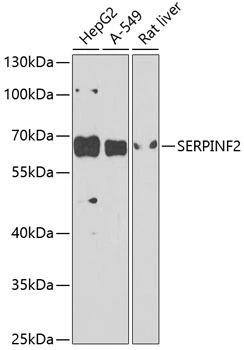 WB analysis of various sample lysates using GTX65993 Alpha 2 Antiplasmin antibody. Dilution : 1:1000 Loading : 25microg per lane