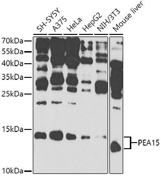 WB analysis of various sample lysates using GTX65994 PEA15 antibody. Dilution : 1:1000 Loading : 25microg per lane
