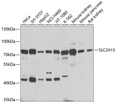 WB analysis of various sample lysates using GTX65995 SLC2A13 antibody. Dilution : 1:1000 Loading : 25microg per lane